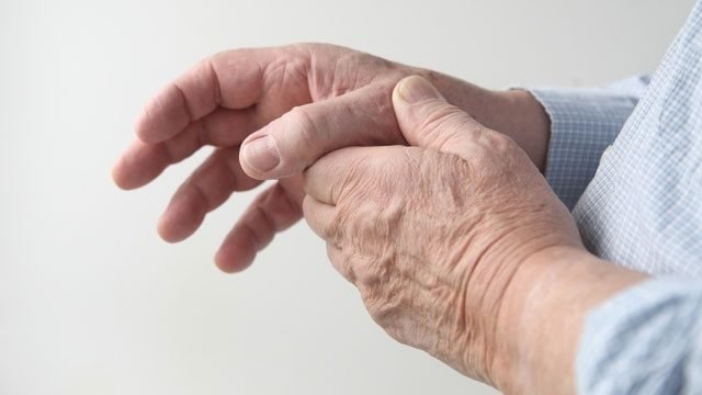 Hands arthritis
