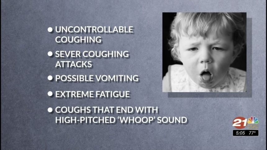 Whooping cough pertussis symptoms