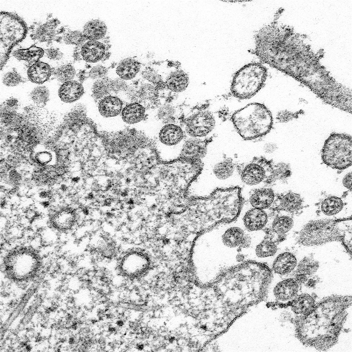 <i>CDC</i><br/>Transmission electron microscopic image of an isolate from the first U.S. case of Covid-19
