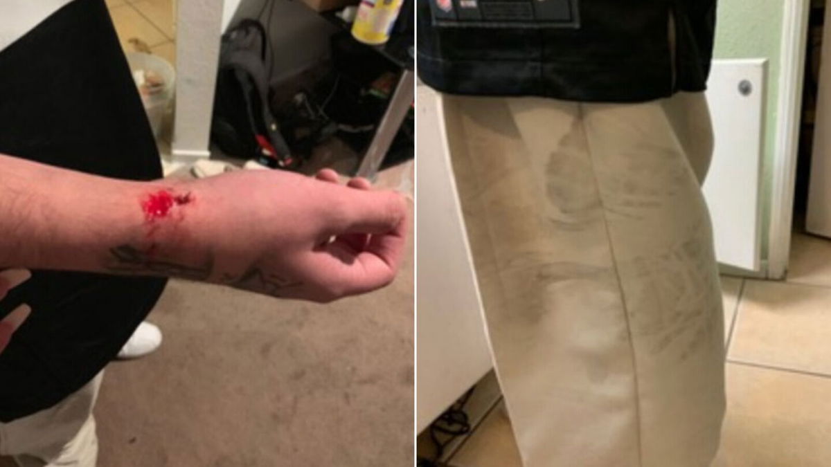 <i>Wesley Ouchi</i><br/>Photos of Anthony Romero's injury as well as of the alleged shoeprints that were provided by his attorney.