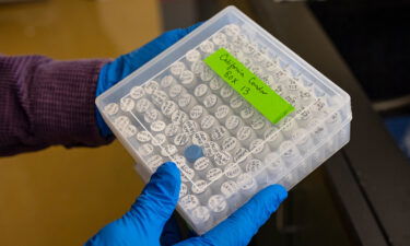 A researcher with the San Diego Zoo Wildlife Alliance holds California condor lab specimens.