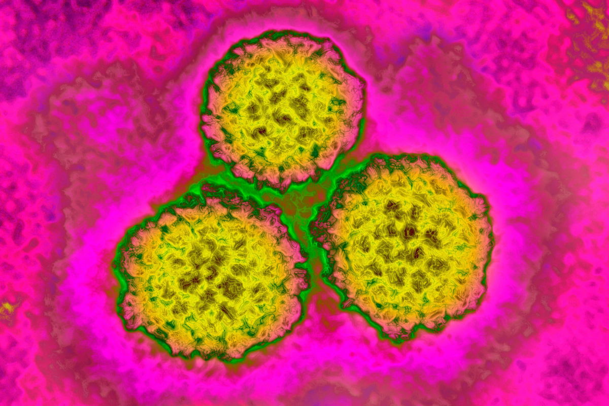 <i>BSIP/Universal Images Group/Getty Images</i><br/>The first generation Human papillomavirus (HPV) vaccine cut cervical cancer rates among women by 87%