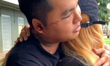 Hieu Bui faced severe blood loss after being slashed across the face with a machete Friday night outside of his home at Kuhio Park Terrance.