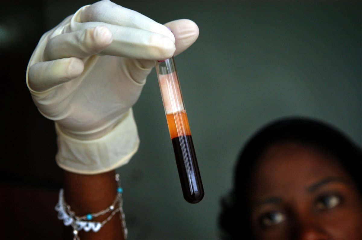 <i>Shaul Schwarz/Getty Images South America/Getty Images</i><br/>Jean Louis looks at a blood sample March 24