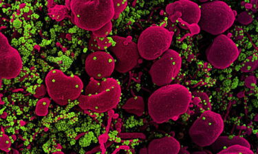 Colorized scanning electron micrograph of an apoptotic cell (pink) heavily infected with SARS-COV-2 virus particles.