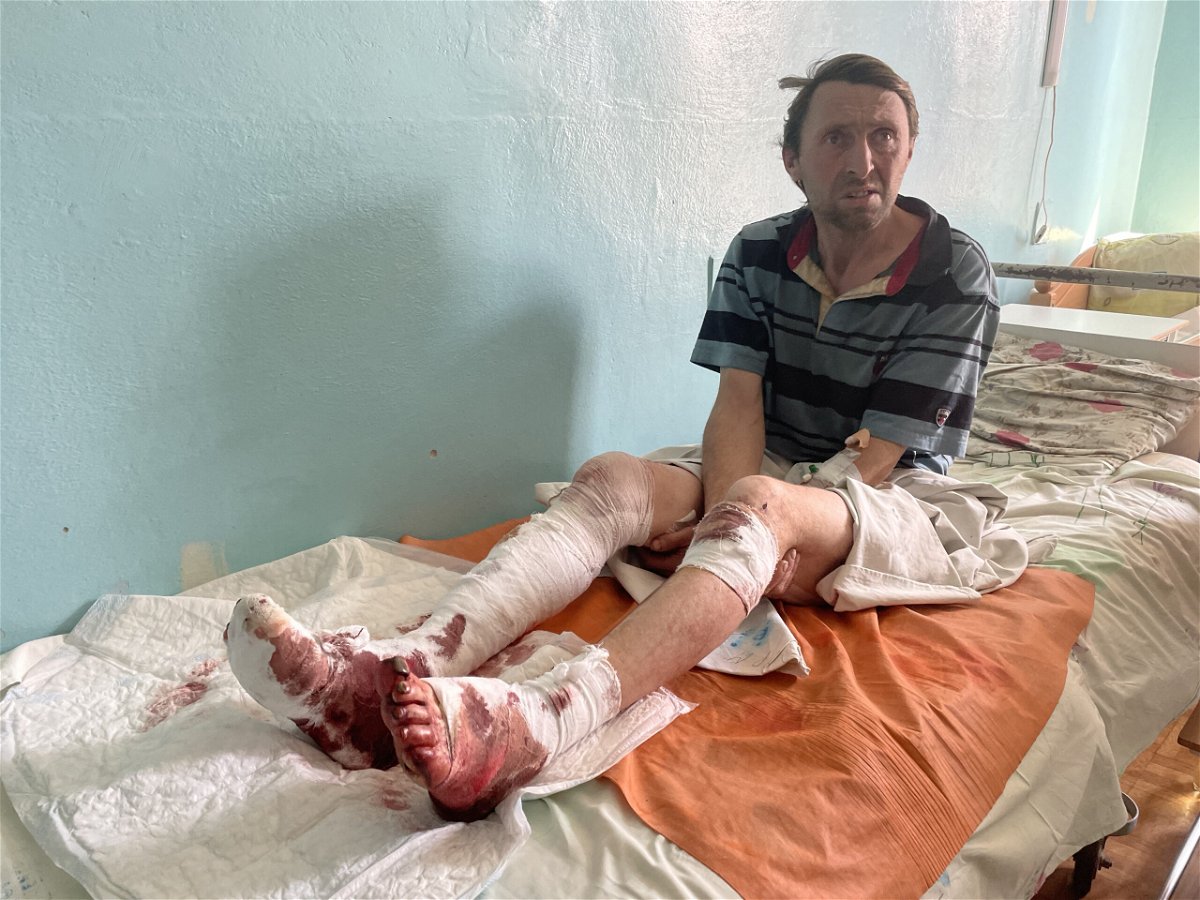 <i>Bex Wright/CNN</i><br/>Igor Rubtsov says he was struck by shelling while feeding animals on the street where he lives.