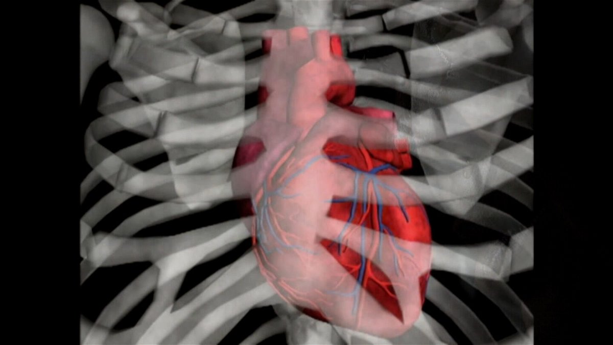 <i>CNN</i><br/>A new medication was added to the recommended treatment plan for people who have heart failure.