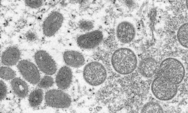 Officials at the US Centers for Disease Control and Prevention are closely tracking recent clusters of monkeypox infections around the world -- and possible cases in the United States.