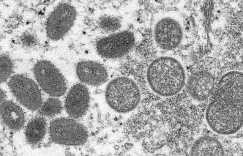 This 2003 electron microscope image made available by the Centers for Disease Control and Prevention shows mature