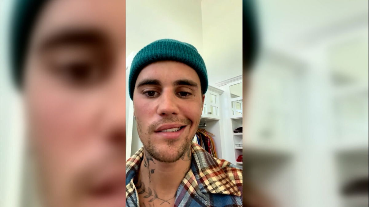 <i>@JustinBieber</i><br/>Justin Bieber has shared a faith-filled update about a rare medical condition that has resulted in one side of his face being paralyzed.