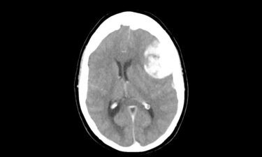 A shortage of a key component for some crucial imaging tests such as CT scans is leading to rationing within hospitals