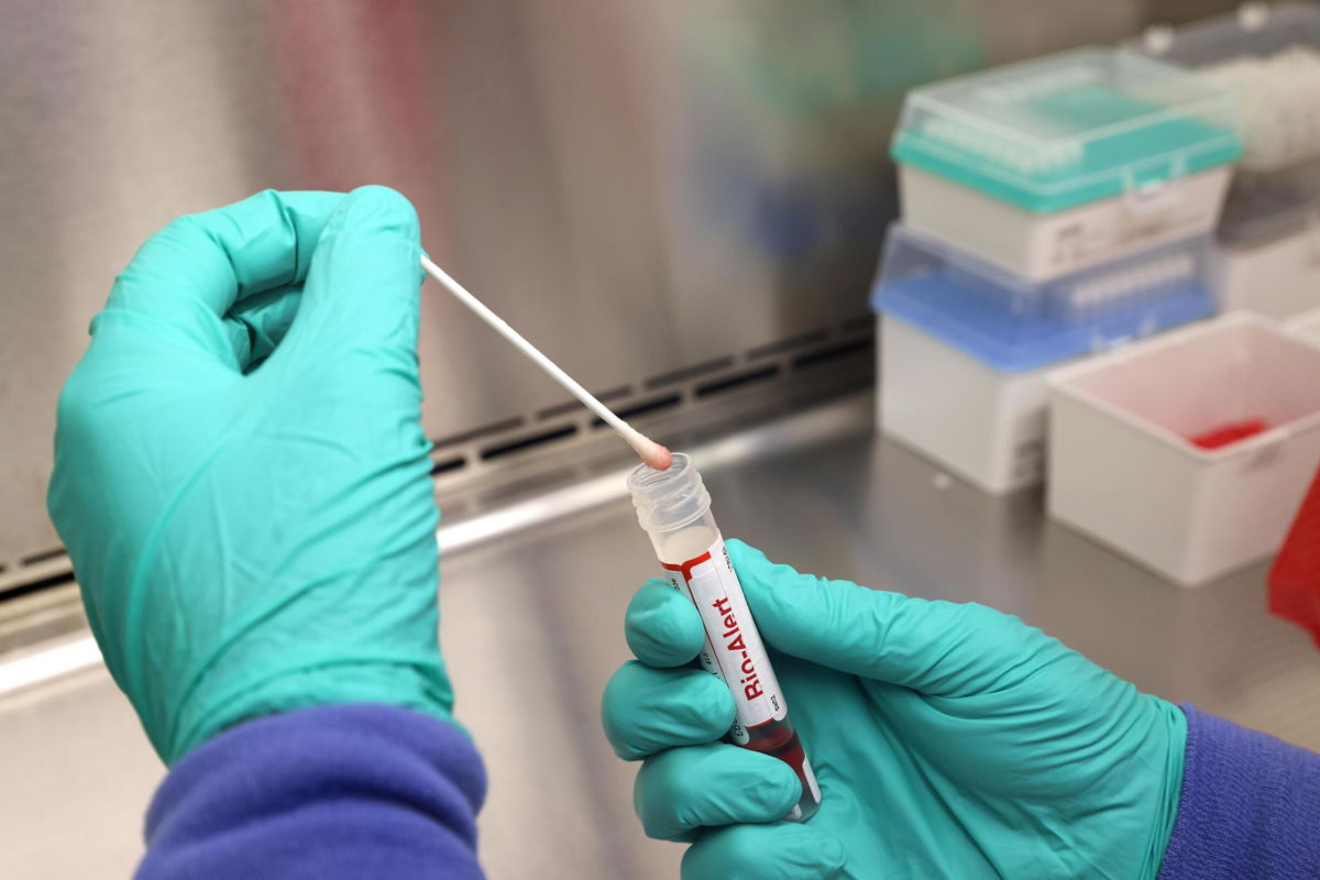 <i>Karen Ducey/Getty Images</i><br/>A swab that tested positive for the Monkeypox virus is seen at the UW Medicine Virology Laboratory on July 12 in Seattle
