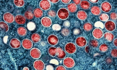 This image provided by the National Institute of Allergy and Infectious Diseases (NIAID) shows a colorized transmission electron micrograph of monkeypox particles (red) found within an infected cell (blue).
