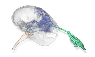 A CT scan shows an aye-aye picking its nose with its long