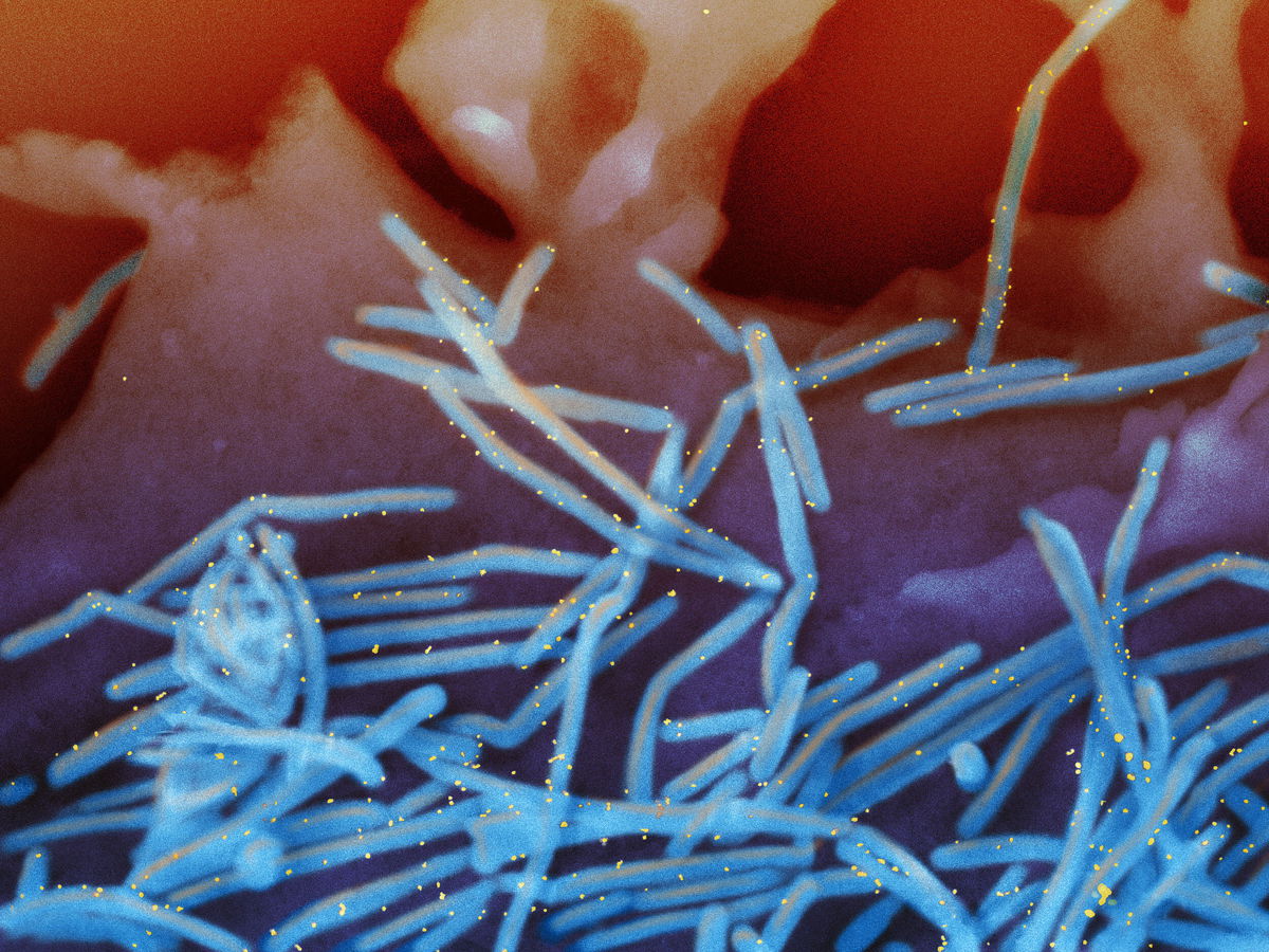 <i>NIAID</i><br/>Scanning electron micrograph of human respiratory syncytial virus (RSV) virions (colorized blue) that are labeled with anti-RSV F protein/gold antibodies (colorized yellow) shedding from the surface of human lung epithelial A549 cells is pictured here.