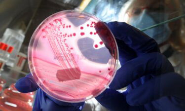 A medical-technical assistant holds a petri dish with a culture medium and bacterial strains of enterohaemorrhagic E. coli (EHEC) in Germany in May 2011. A new antibiotic appears to be effective against urinary tract infections.