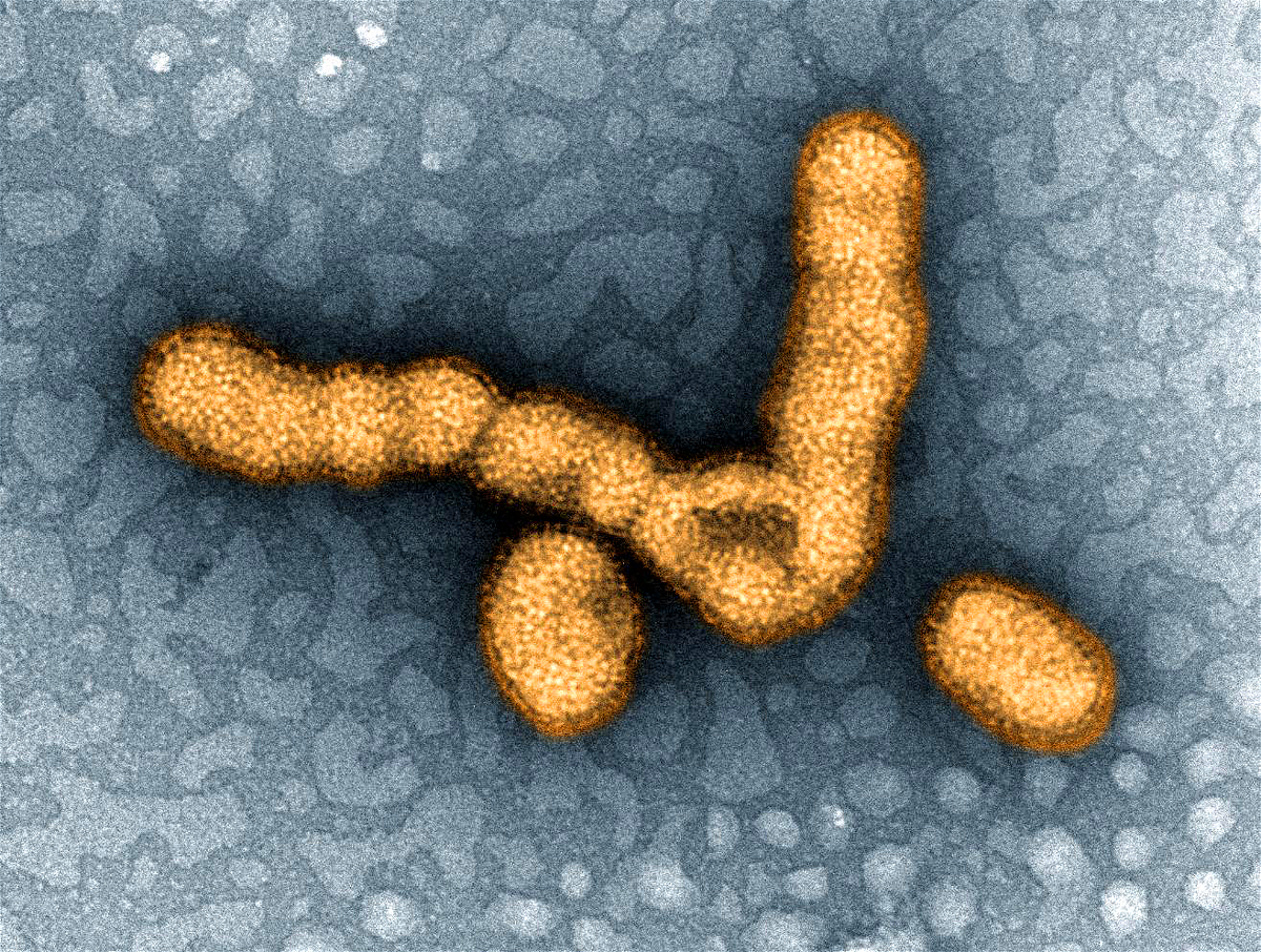 <i>NIAID</i><br/>Researchers make important progress toward a possible universal flu vaccine. In 2009