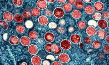 This image provided by the National Institute of Allergy and Infectious Diseases (NIAID) shows a colorized transmission electron micrograph of monkeypox particles (red) found within an infected cell (blue)