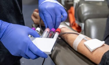 The FDA proposes individual risk assessments for blood donors