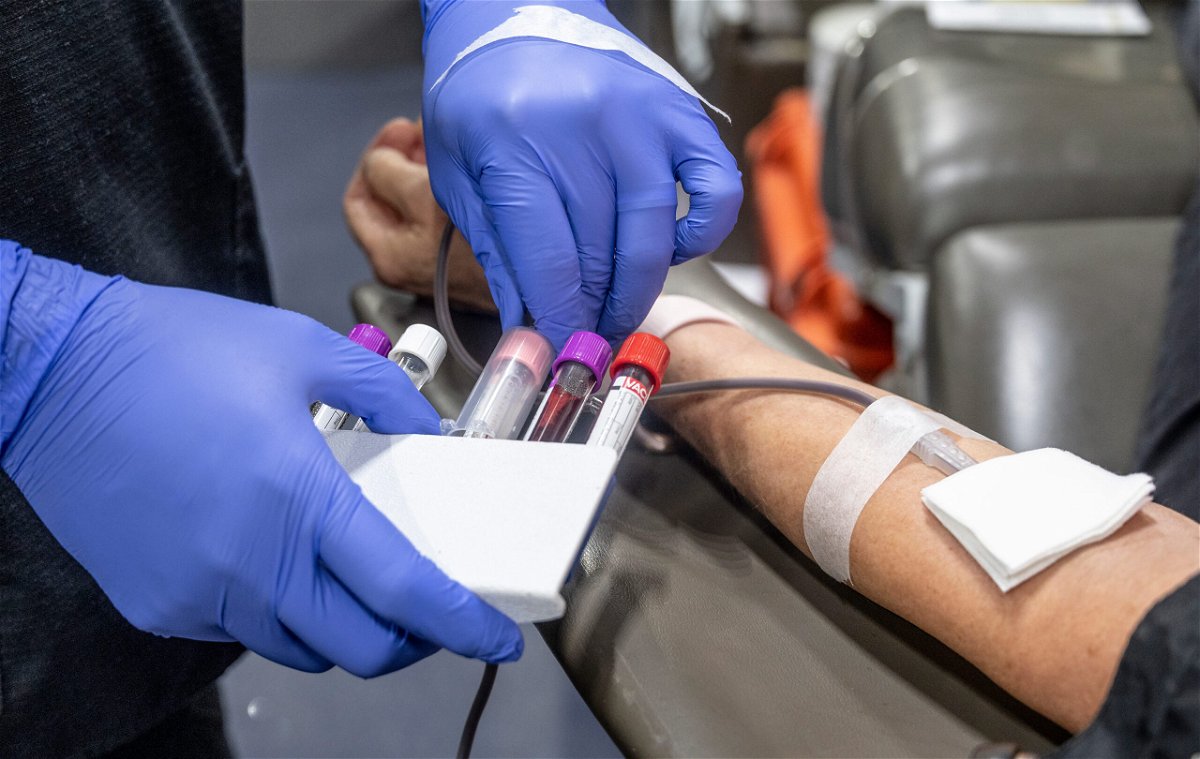 <i>Paul Bersebach/MediaNews Group/Orange County Register/Getty Images</i><br/>The FDA proposes individual risk assessments for blood donors