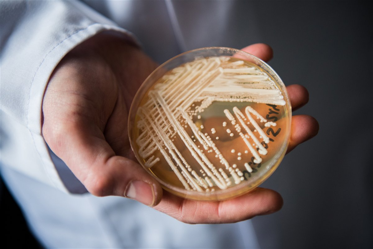 <i>Nicolas Armer/picture alliance/Getty Images/FILE</i><br/>Clinical cases of Candida auris