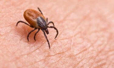 Tickborne disease has been on the rise in the US