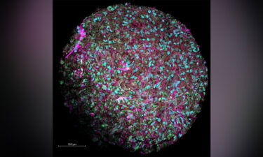 This magnified image shows a brain organoid produced in Hartung's lab. The culture was dyed to show neurons in magenta