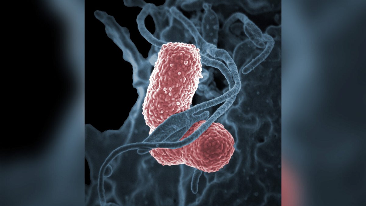 <i>National Institute on Allergy and Infectious Diseases/NIH</i><br/>A medical center in Seattle is investigating an outbreak of Klebsiella bacteria.