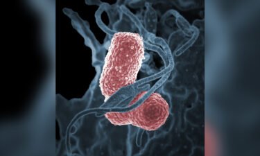A medical center in Seattle is investigating an outbreak of Klebsiella bacteria.