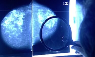 Breast cancer screenings are typically performed using a mammogram