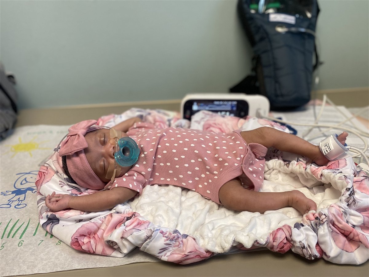 <i>Courtesy the Coleman family</i><br/>Doctors performed an in utero procedure on Denver Coleman to eliminate dangerous symptoms from a vascular malformation in her brain.
