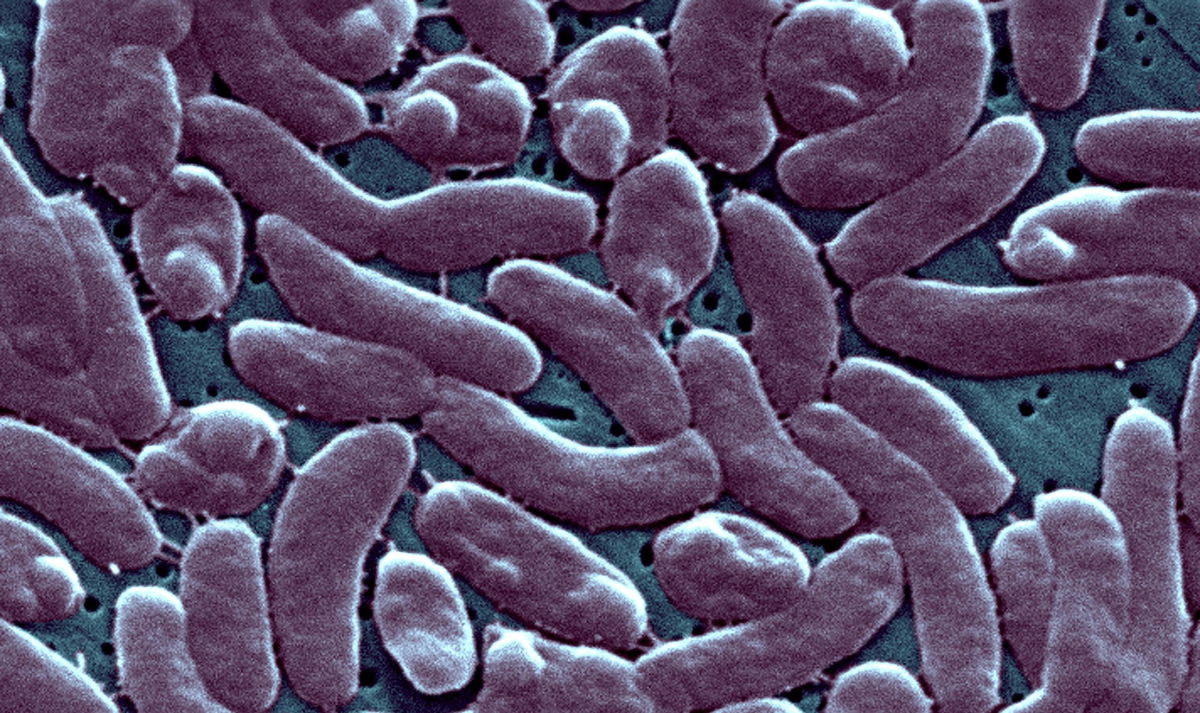 <i>BSIP/Universal Images Group/Getty Images</i><br/>Vibrio vulnificus lives in warm