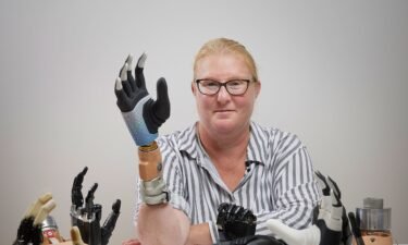 Karin’s prosthesis is considered bionic because it is attached to her nervous system as well as to the muscle and bone.