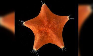 The nervous system of a starfish is shown here during an analysis.