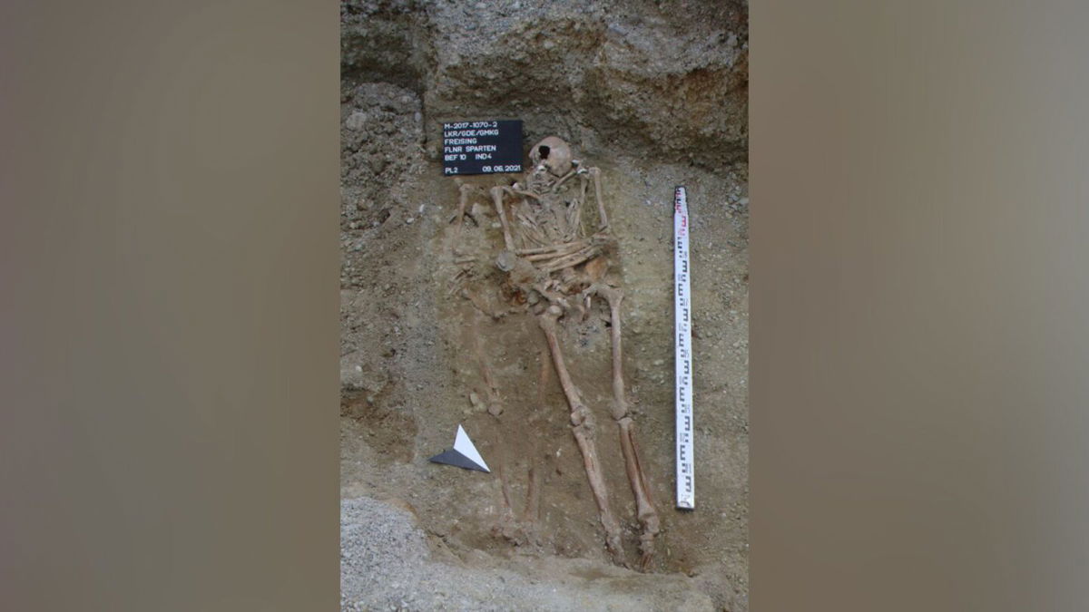 <i>Bayerisches Landesamt für Denkmalpflege</i><br/>Archaeologists working in the Bavarian town of Freising found the remains of a man with a metal prosthesis replacing four missing fingers.