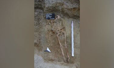 Archaeologists working in the Bavarian town of Freising found the remains of a man with a metal prosthesis replacing four missing fingers.