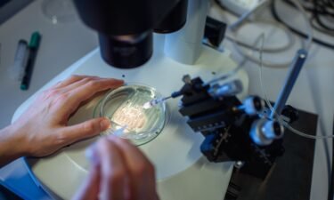 A researcher handles a petri dish while observing a CRISPR/Cas9 process through a stereomicroscope at the Max-Delbrueck-Centre for Molecular Medicine.