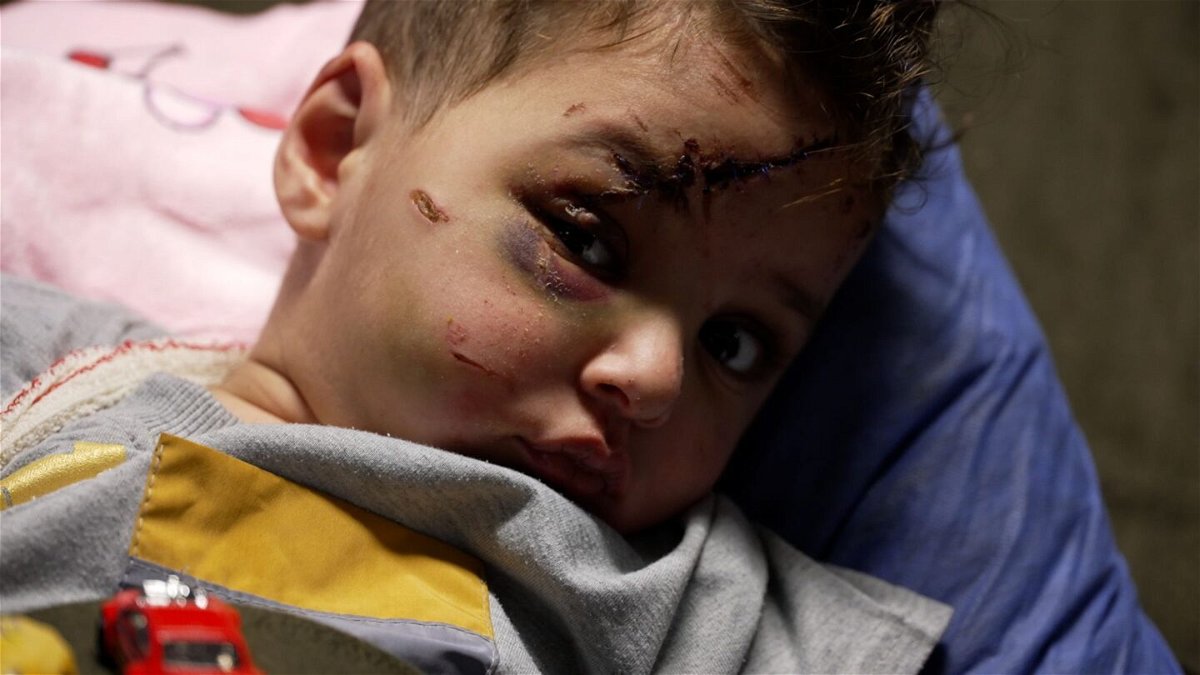 <i>Brent Swails/CNN</i><br/>Dr. Abdallah Al-Naqbi checks on toddler Amir and his wounds.