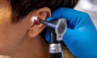 Hearing aids without a prescription could make them more accessible