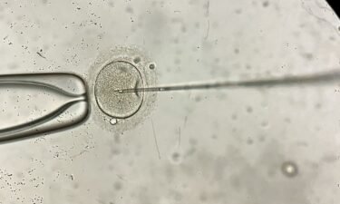 Remarkable macro view through the microscope at process of the in vitro fertilization of a female egg inside IVF dish in the laboratory. Horizontal.