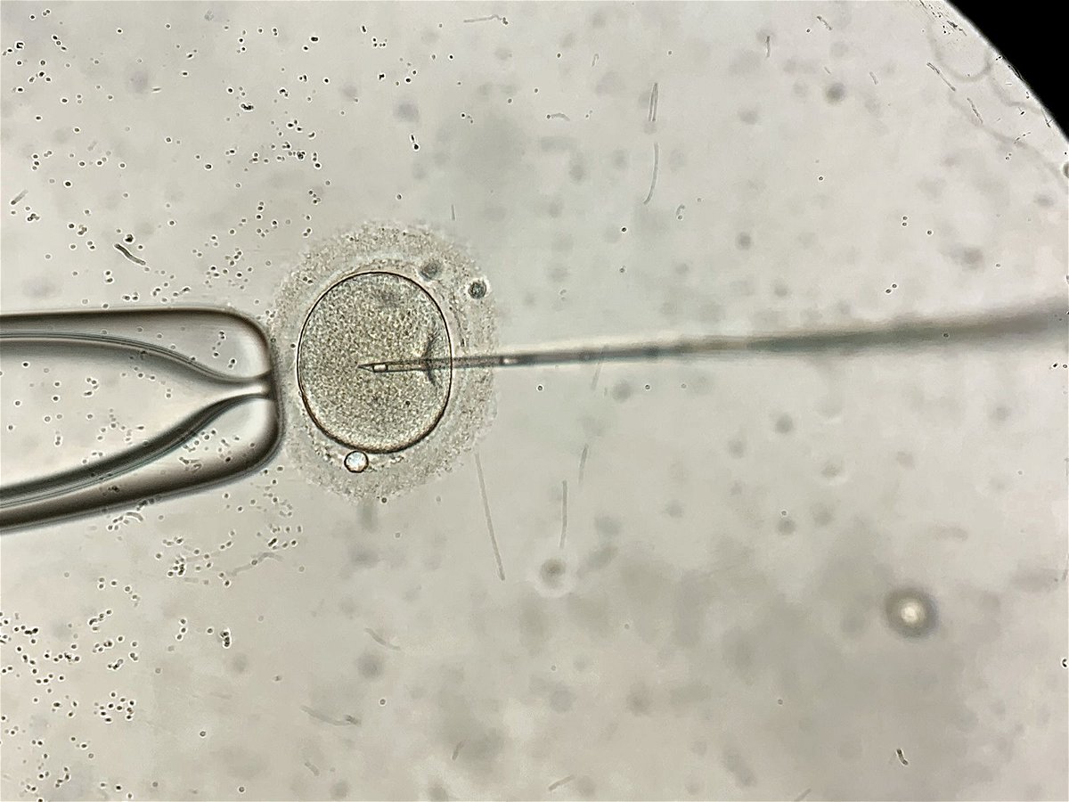 <i>Shutterstock</i><br/>Remarkable macro view through the microscope at process of the in vitro fertilization of a female egg inside IVF dish in the laboratory. Horizontal.
