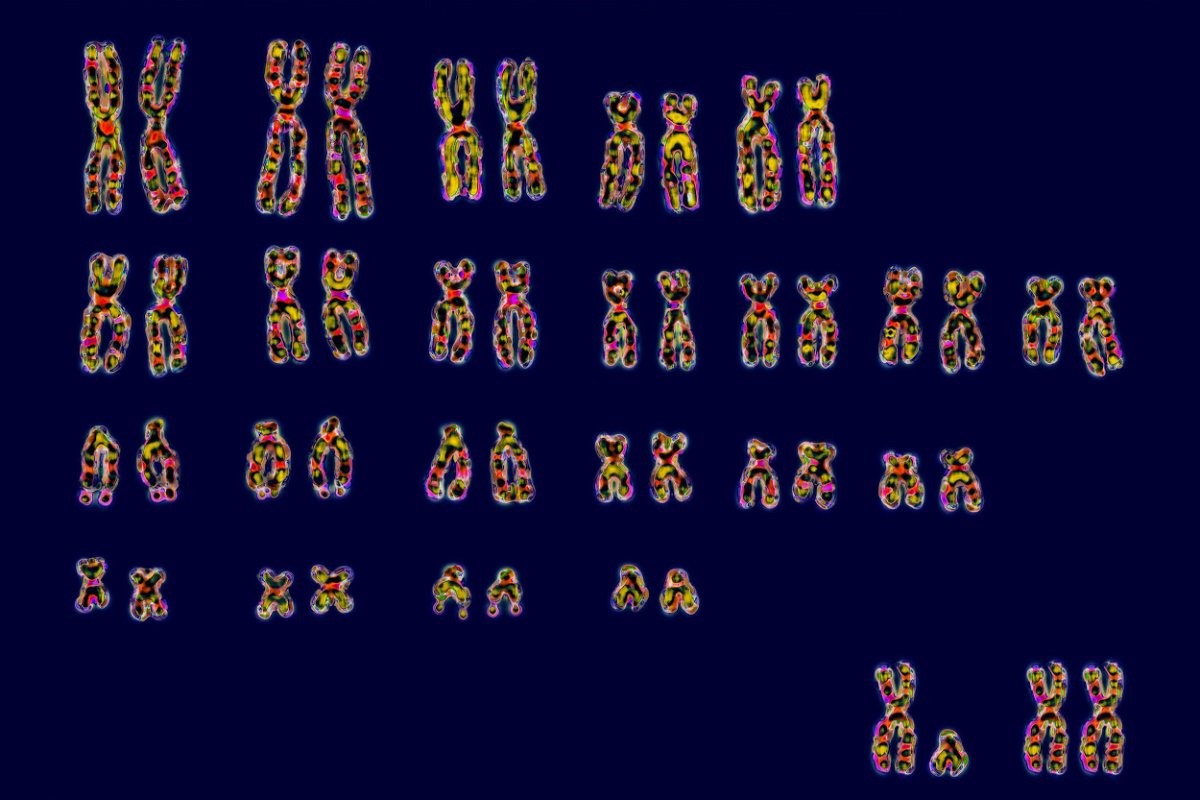<i>BSIP/Universal Images Group/Getty Images</i><br/>Humans have 23 pairs of chromosomes. At bottom right are the pair of sex chromosomes XY or XX that determines sex.