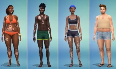 "The Sims 4" debuts the game’s first vitiligo skin feature.