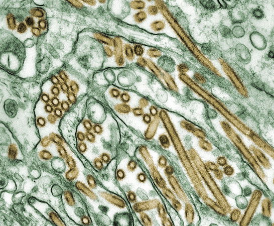 A person who worked on a dairy farm and had “direct contact with dairy cattle” tested positive for bird flu in Texas, according to state health officials.