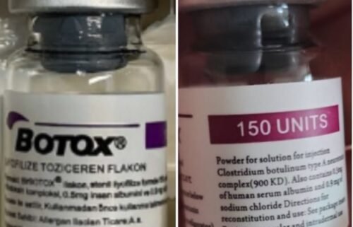Consumers should report suspected counterfeit Botox products to FDA at 800-551-3989