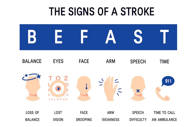 If symptoms of stroke are recognized within the first four and a half hours, experts said irreversible damage can be prevented. 