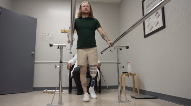 <i>WBBM via CNN Newsource</i><br/>Reum allowed CBS 2's cameras to capture him taking his very first steps without his crutches. Prosthetist Norbert Fliess coached him through it. Reum will need hours of therapy to get him up to speed.