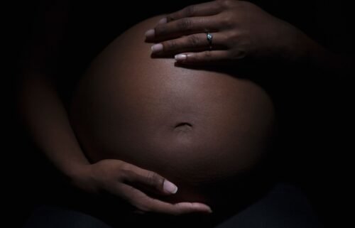 Despite a fall in the US maternal mortality rate in 2022
