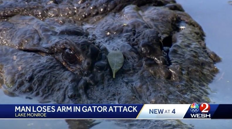 <i>WESH via CNN Newsource</i><br/>Officials with the Florida Fish and Wildlife Conservation Commission said they were called just before 2 a.m. on June 16 about a gator attack at Lake Monroe. The attack left a man amputated