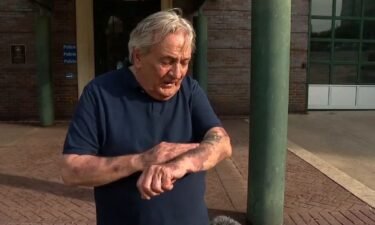 Bob Campbell shows bruises on his arms. He along with two others say they were attacked and beaten during a Palestinian Resistance event held at the West Asheville Library.